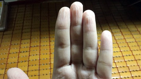 Da tay nhăn nheo vì ngâm nước: có sao không? - Ảnh 1. Da tay nhăn nheo vì ngâm nước: có sao không? - Ảnh 1.