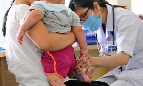 Đồng Nai khẩn trương chống dịch sốt xuất huyết, tay chân miệng - Ảnh 1. Đồng Nai khẩn trương chống dịch sốt xuất huyết, tay chân miệng - Ảnh 1.