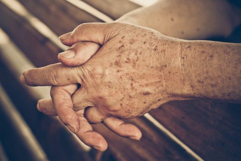 Phòng bệnh ngoài da ở người cao tuổi - Ảnh 1. Phòng bệnh ngoài da ở người cao tuổi - Ảnh 1.