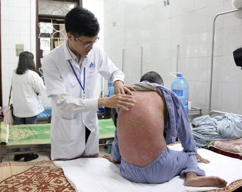 Điều trị bệnh vảy nến bằng UVB dải hẹp toàn thân - Ảnh 1. Điều trị bệnh vảy nến bằng UVB dải hẹp toàn thân - Ảnh 1.