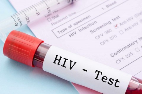 Xét nghiệm HIV sớm: Tiền đề để đạt mục tiêu 90-90-90 - Ảnh 1. Xét nghiệm HIV sớm: Tiền đề để đạt mục tiêu 90-90-90 - Ảnh 1.