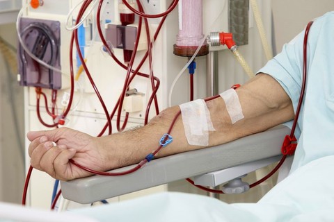 Những điều cần biết về chạy thận nhân tạo - Ảnh 1. Những điều cần biết về chạy thận nhân tạo - Ảnh 1.