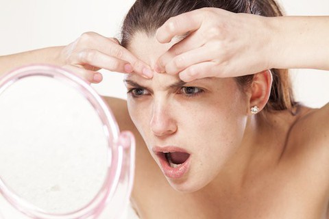 Mách bạn bí quyết chăm sóc da đúng cách sau khi nặn mụn - Ảnh 1. Mách bạn bí quyết chăm sóc da đúng cách sau khi nặn mụn - Ảnh 1.