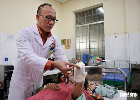 Nối bàn tay bị đứt lìa do máy xay cỏ - Ảnh 1. Nối bàn tay bị đứt lìa do máy xay cỏ - Ảnh 1.
