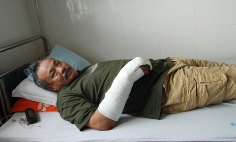 Truy tìm tên trộm đâm chủ nhà trọng thương để tẩu thoát - Ảnh 1. Truy tìm tên trộm đâm chủ nhà trọng thương để tẩu thoát - Ảnh 1.