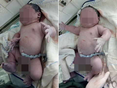 Kỷ lục: em bé sơ sinh nặng 7,1 kg - Ảnh 1. Kỷ lục: em bé sơ sinh nặng 7,1 kg - Ảnh 1.