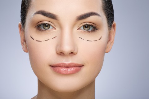 Cắt mí mắt, đừng để xấu vì thiếu hiểu biết - Ảnh 1. Cắt mí mắt, đừng để xấu vì thiếu hiểu biết - Ảnh 1.