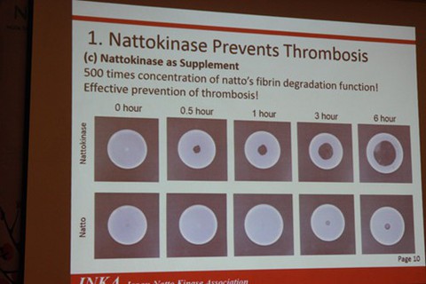 Nattokinase Nhật Bản: Giúp đánh tan máu đông, ngừa đột quỵ - Ảnh 1. Nattokinase Nhật Bản: Giúp đánh tan máu đông, ngừa đột quỵ - Ảnh 1.