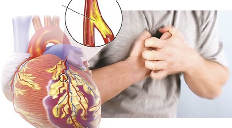 Tác hại của bệnh tiểu đường trên mạch máu - Ảnh 1. Tác hại của bệnh tiểu đường trên mạch máu - Ảnh 1.