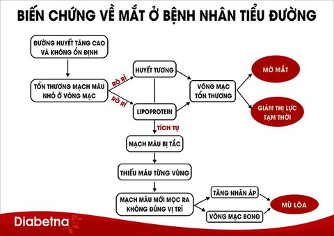 4 cách đơn giản giảm nguy cơ mù lòa ở bệnh nhân tiểu đường - Ảnh 1. 4 cách đơn giản giảm nguy cơ mù lòa ở bệnh nhân tiểu đường - Ảnh 1.
