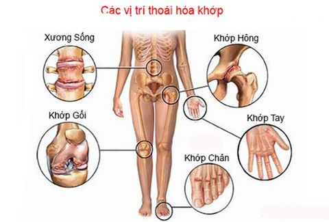 Thuốc điều trị, hỗ trợ trong bệnh lý về khớp - Ảnh 1. Thuốc điều trị, hỗ trợ trong bệnh lý về khớp - Ảnh 1.