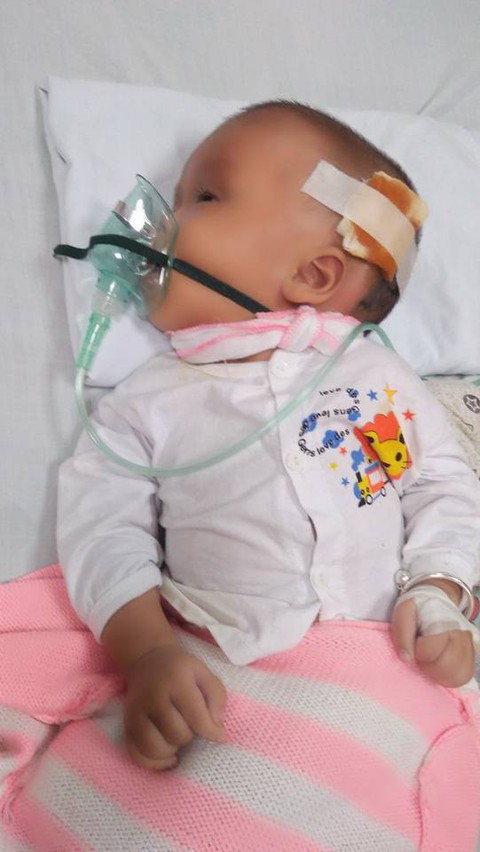 Người mẹ 18 tuổi và phép màu cứu con bị não úng thủy - Ảnh 2. Người mẹ 18 tuổi và phép màu cứu con bị não úng thủy - Ảnh 2.