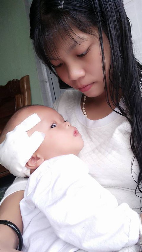 Người mẹ 18 tuổi và phép màu cứu con bị não úng thủy - Ảnh 3. Người mẹ 18 tuổi và phép màu cứu con bị não úng thủy - Ảnh 3.
