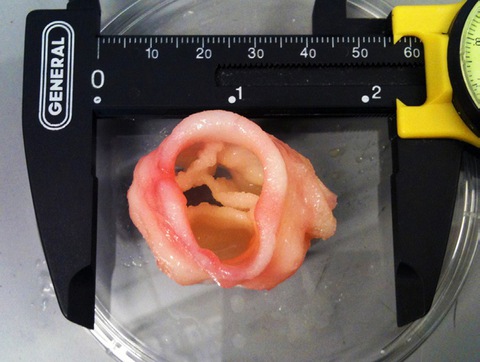 In 3D đang tạo ra phép màu trong y học - Ảnh 10. In 3D đang tạo ra phép màu trong y học - Ảnh 10.