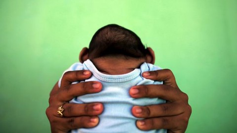 Dùng virút Zika điều trị u não GBM tăng triển - Ảnh 1. Dùng virút Zika điều trị u não GBM tăng triển - Ảnh 1.