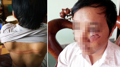Phạt hành chính trong lĩnh vực giáo dục: Phải có, dù không muốn! - Ảnh 1. Phạt hành chính trong lĩnh vực giáo dục: Phải có, dù không muốn! - Ảnh 1.