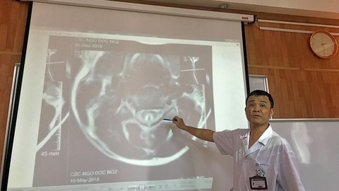 Tổn thương tủy sống vì bóng cười - Ảnh 1. Tổn thương tủy sống vì bóng cười - Ảnh 1.