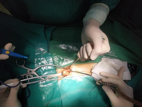Cứu cháu bé 9 tuổi có thể nguy kịch chỉ vì một vết xước - Ảnh 1. Cứu cháu bé 9 tuổi có thể nguy kịch chỉ vì một vết xước - Ảnh 1.