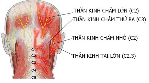 Đau dây thần kinh chẩm - Ảnh 1. Đau dây thần kinh chẩm - Ảnh 1.