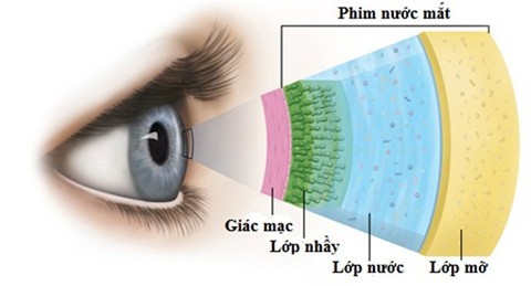 Khô mắt - nguyên nhân và điều trị - Ảnh 1. Khô mắt - nguyên nhân và điều trị - Ảnh 1.