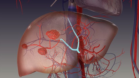 U máu trong gan có thực sự đáng sợ? - Ảnh 1. U máu trong gan có thực sự đáng sợ? - Ảnh 1.