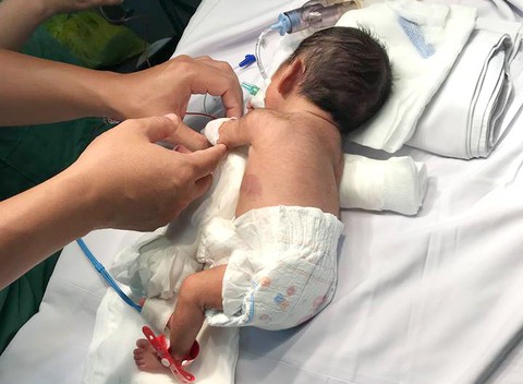 Phẫu thuật thành công ca tim bẩm sinh tại tuyến tỉnh - Ảnh 1. Phẫu thuật thành công ca tim bẩm sinh tại tuyến tỉnh - Ảnh 1.