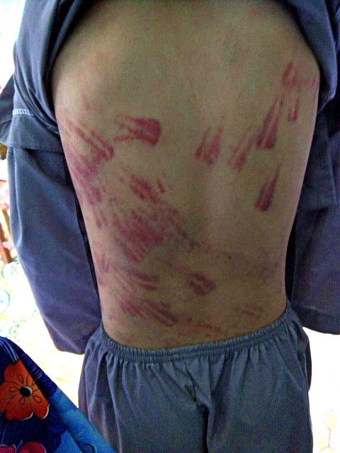 Xác minh vụ bé trai 10 tuổi nghi bị bạo hành - Ảnh 2. Xác minh vụ bé trai 10 tuổi nghi bị bạo hành - Ảnh 2.