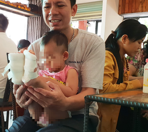Trẻ bị bỏng ở trường mầm non, ai bồi thường? - Ảnh 1. Trẻ bị bỏng ở trường mầm non, ai bồi thường? - Ảnh 1.