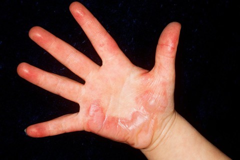 Tại sao đá khô lại nguy hiểm? - Ảnh 1. Tại sao đá khô lại nguy hiểm? - Ảnh 1.