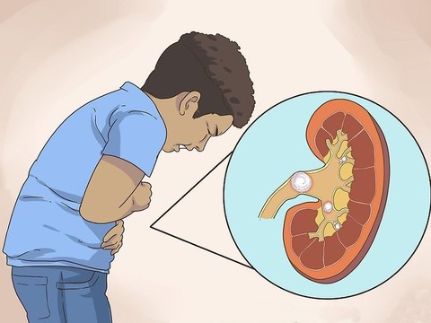 Những điều cần biết về hội chứng thận hư ở trẻ em - Ảnh 1. Những điều cần biết về hội chứng thận hư ở trẻ em - Ảnh 1.