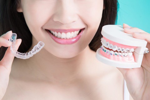 Niềng răng để khỏe, đẹp hơn - Ảnh 6. Niềng răng để khỏe, đẹp hơn - Ảnh 6.