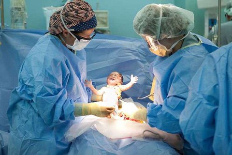 Sinh mổ tiềm ẩn nhiều nguy cơ cho mẹ và bé - Ảnh 1. Sinh mổ tiềm ẩn nhiều nguy cơ cho mẹ và bé - Ảnh 1.