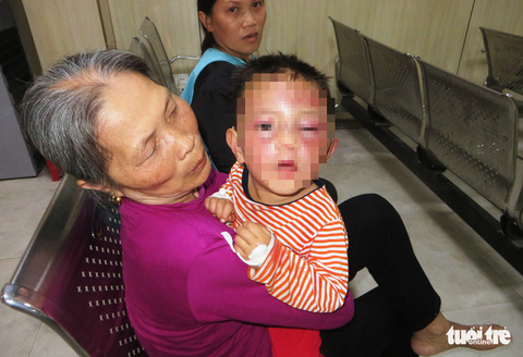 Bé 2 tuổi nghi bị cha dượng tâm thần đánh tím mặt - Ảnh 1. Bé 2 tuổi nghi bị cha dượng tâm thần đánh tím mặt - Ảnh 1.