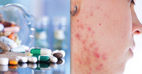 Thuốc giảm mỡ máu và tác dụng ngoại ý - Ảnh 1. Thuốc giảm mỡ máu và tác dụng ngoại ý - Ảnh 1.