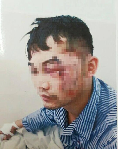 Xác minh vụ con nợ dùng đao, kiếm chém trọng thương chủ nợ - Ảnh 1. Xác minh vụ con nợ dùng đao, kiếm chém trọng thương chủ nợ - Ảnh 1.