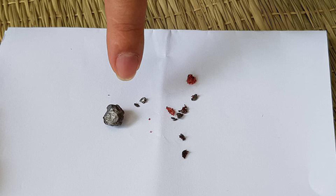Can ngăn đánh nhau bất ngờ bị bắn nhiều phát - Ảnh 2. Can ngăn đánh nhau bất ngờ bị bắn nhiều phát - Ảnh 2.