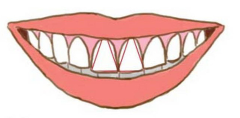 Nhìn răng biết tính cách? - Ảnh 4. Nhìn răng biết tính cách? - Ảnh 4.