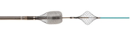 Sáng chế mới trong điều trị tắc nghẽn mạch máu - Ảnh 3. Sáng chế mới trong điều trị tắc nghẽn mạch máu - Ảnh 3.