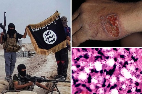 Căn nguyên bệnh chiến binh Hồi giáo tại Syria là do đâu? - Ảnh 1. Căn nguyên bệnh chiến binh Hồi giáo tại Syria là do đâu? - Ảnh 1.