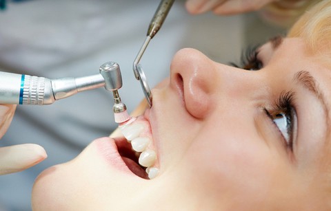 Khi nào nên lấy cao răng? - Ảnh 1. Khi nào nên lấy cao răng? - Ảnh 1.