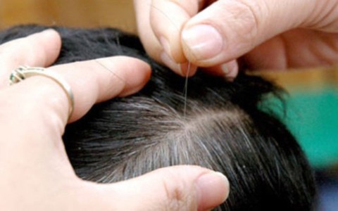 Tóc bạc mẹ tôi, từng sợi nhớ, sợi thương - Ảnh 1. Tóc bạc mẹ tôi, từng sợi nhớ, sợi thương - Ảnh 1.