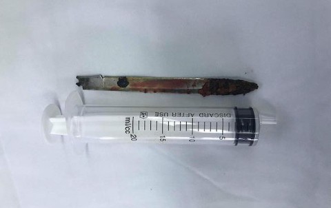 Lưỡi dao 13cm ‘ngủ quên’ ở lưng chiến sĩ công an suốt 11 năm - Ảnh 2. Lưỡi dao 13cm ‘ngủ quên’ ở lưng chiến sĩ công an suốt 11 năm - Ảnh 2.