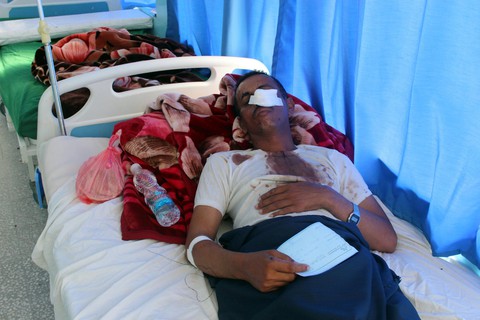 Yemen: Đang ăn cưới bị dội bom, ít nhất 40 người chết - Ảnh 1. Yemen: Đang ăn cưới bị dội bom, ít nhất 40 người chết - Ảnh 1.