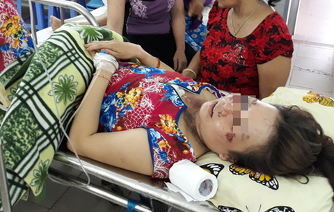 Sét đánh đứt dây chuyền vàng, người đeo cháy cổ - Ảnh 1. Sét đánh đứt dây chuyền vàng, người đeo cháy cổ - Ảnh 1.