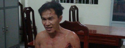 Bắt nghi phạm chém lìa đầu nạn nhân, chém luôn công an - Ảnh 2. Bắt nghi phạm chém lìa đầu nạn nhân, chém luôn công an - Ảnh 2.