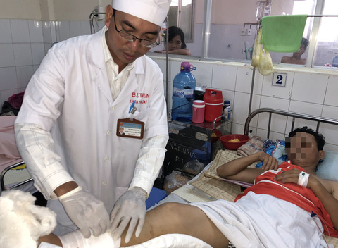 Nối thành công chân của nạn nhân bị máy cắt cỏ cắt lìa - Ảnh 1. Nối thành công chân của nạn nhân bị máy cắt cỏ cắt lìa - Ảnh 1.