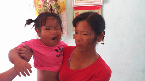 Nghi vấn cô giáo mầm non đánh bé 3 tuổi méo miệng - Ảnh 1. Nghi vấn cô giáo mầm non đánh bé 3 tuổi méo miệng - Ảnh 1.