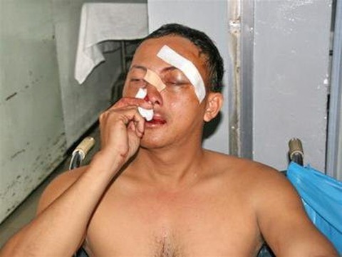 Nhóm trộm đâm chết 2 ‘hiệp sĩ’ nhiều lần rút dao tấn công ‘hiệp sĩ’ - Ảnh 2. Nhóm trộm đâm chết 2 ‘hiệp sĩ’ nhiều lần rút dao tấn công ‘hiệp sĩ’ - Ảnh 2.