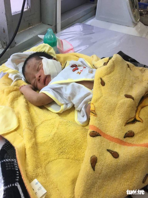 Cứu chữa kịp thời bé sơ sinh bị chôn sống - Ảnh 1. Cứu chữa kịp thời bé sơ sinh bị chôn sống - Ảnh 1.