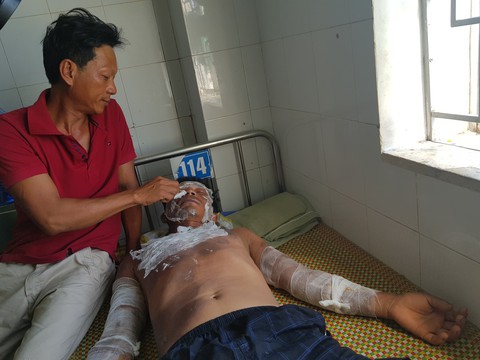 Tàu cá bất ngờ cháy giữa biển, 2 ngư dân bị bỏng - Ảnh 1.